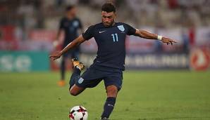 Alex Oxlade-Chamberlain droht das WM-Aus.