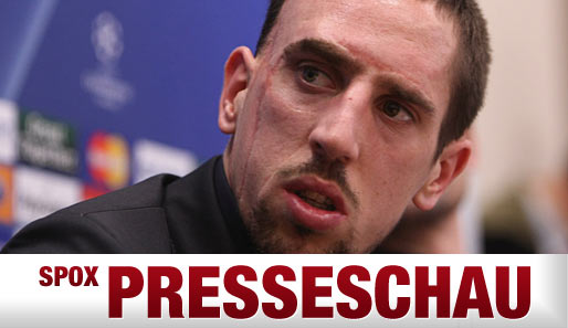 Franck Ribery