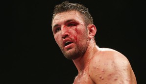 Hughie Fury will sich den WBA-Titel gegen Joseph Parker erkämpfen